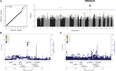 PRICKLE1 × FOCAD Interaction Revealed by Genome-Wide vQTL Analysis of Human Facial Traits